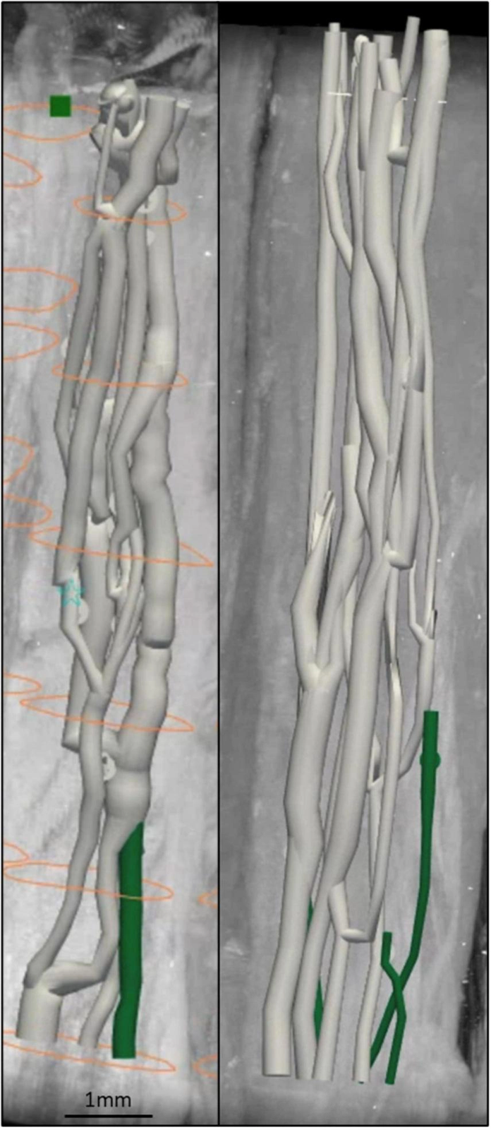 Fascicles in the human cervical vagus plait, merge and split continuously along the trunk. Image from Thompson et al.4. The split and merge rate quoted in the text is from Upadhye et al.5.